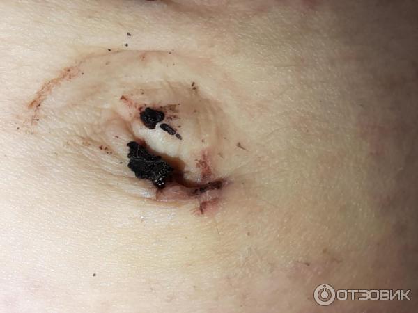 Мазь для наружного применения Фармпрепарат Стелланин фото