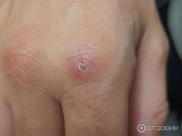 Мазь для наружного применения Фармпрепарат Стелланин фото