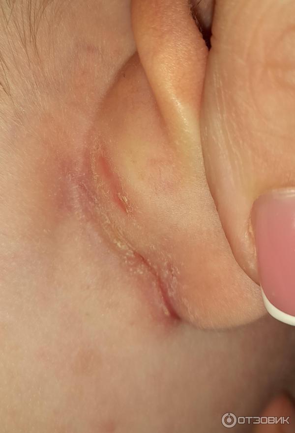 Мазь для наружного применения Фармпрепарат Стелланин фото