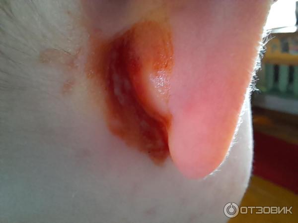 Мазь для наружного применения Фармпрепарат Стелланин фото