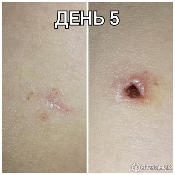 Мазь для наружного применения Фармпрепарат Стелланин фото