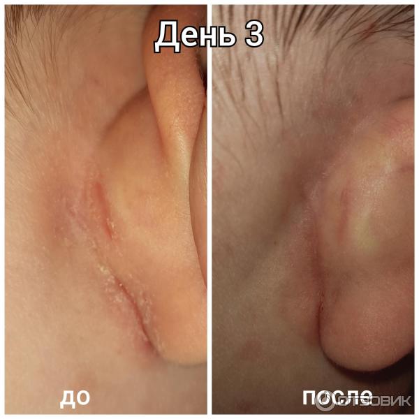 Мазь для наружного применения Фармпрепарат Стелланин фото