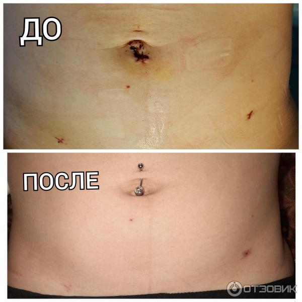 Мазь для наружного применения Фармпрепарат Стелланин фото