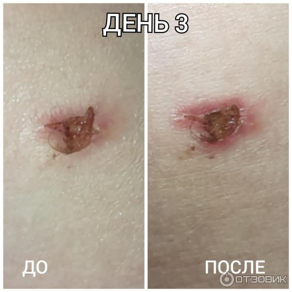 Мазь для наружного применения Фармпрепарат Стелланин фото