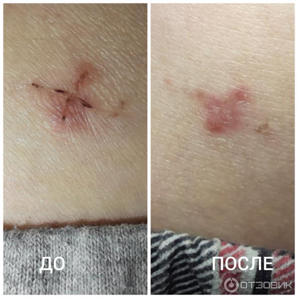 Мазь для наружного применения Фармпрепарат Стелланин фото