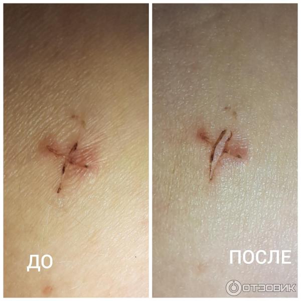 Мазь для наружного применения Фармпрепарат Стелланин фото