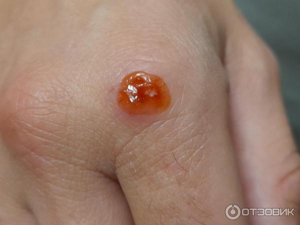 Мазь для наружного применения Фармпрепарат Стелланин фото