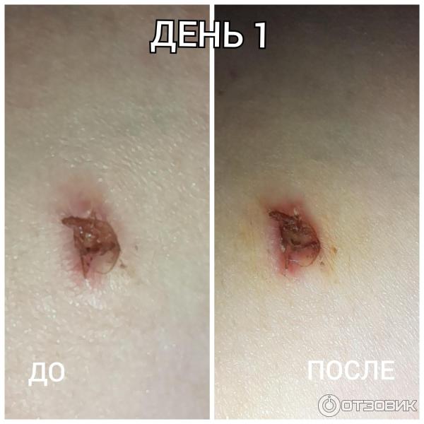 Мазь для наружного применения Фармпрепарат Стелланин фото