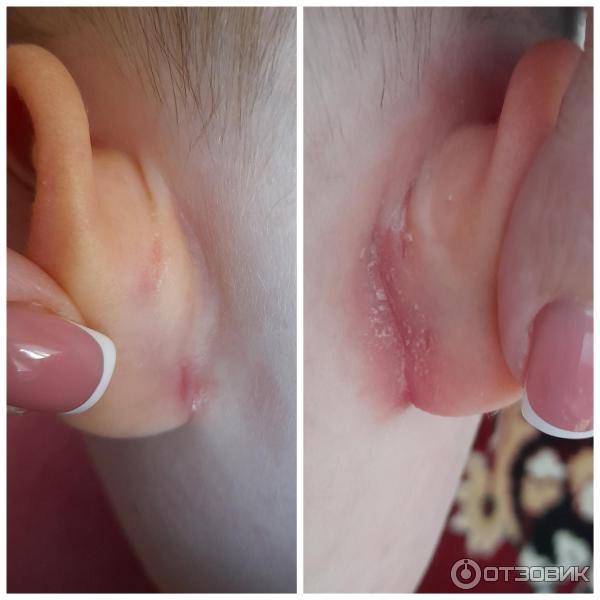 Мазь для наружного применения Фармпрепарат Стелланин фото