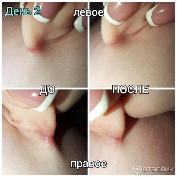 Мазь для наружного применения Фармпрепарат Стелланин фото