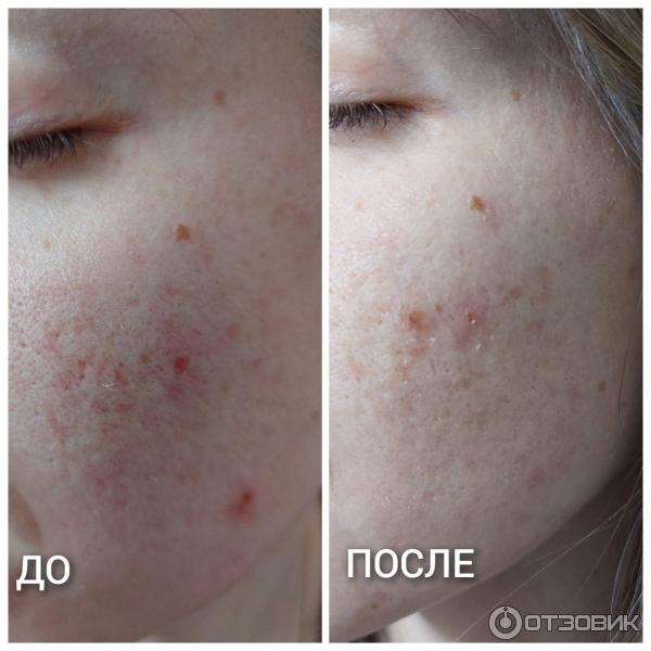 Гель для умывания La Roche-Posay EFFACLAR GEL фото