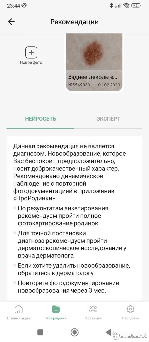 Отзыв о Про родинки - программа для Android | Мой опыт работы с этим  приложением подтвержден дерматологом с дерматоскопом!