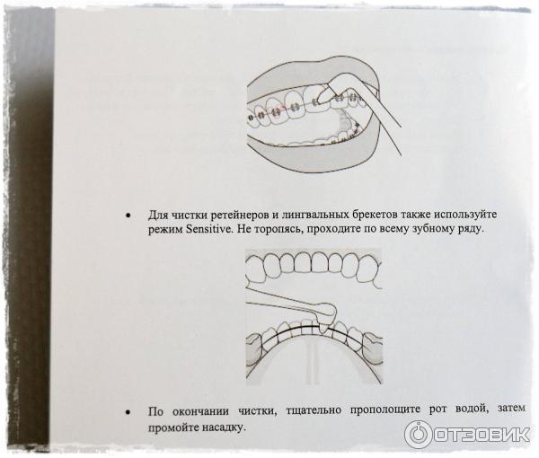 Электрическая зубная щетка Polaris PETB 0701 TC фото