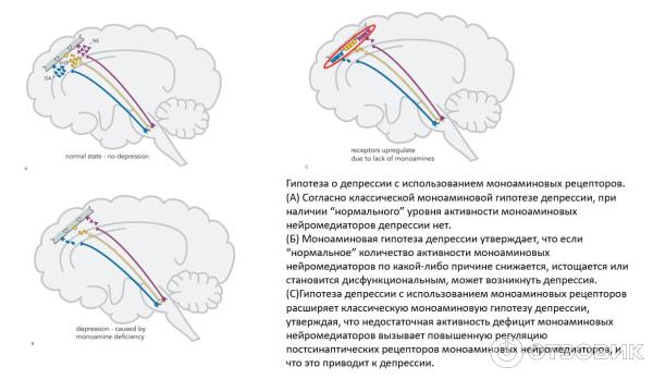 Моноаминовая гипотеза депрессии