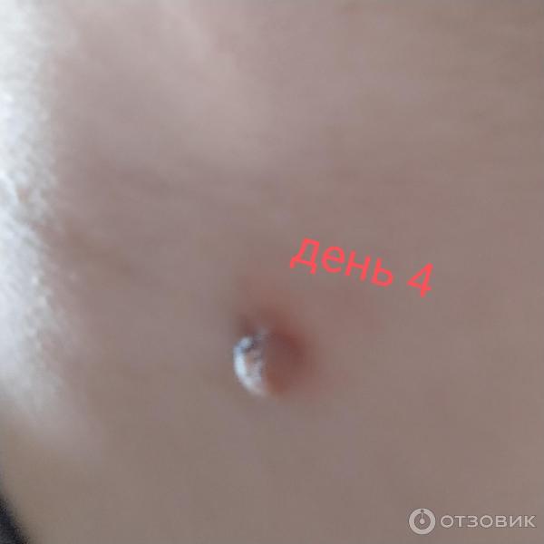 Отзыв о Крем-гель косметический Алфит Плюс "ПапилломаФит" | Справился