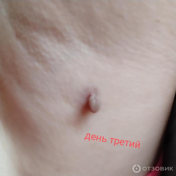 Отзыв о Крем-гель косметический Алфит Плюс "ПапилломаФит" | Справился