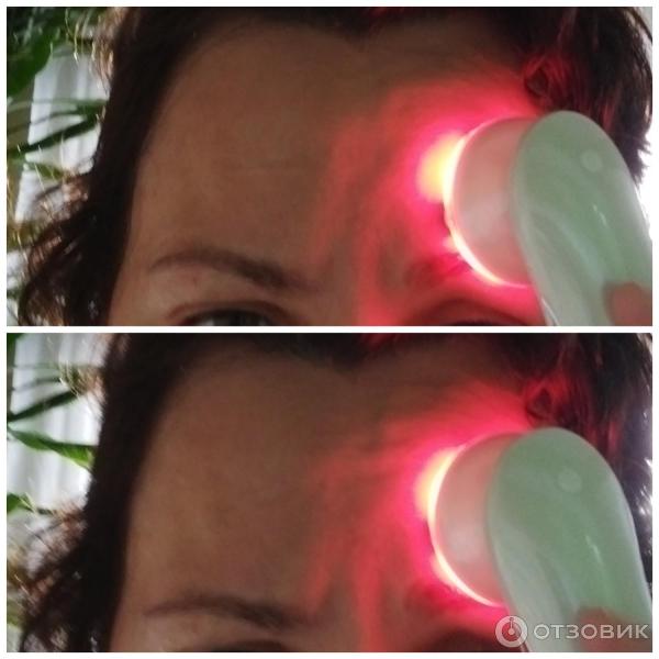 Аппарат мезотерапии RF и EMS Luxlifting Targo фото